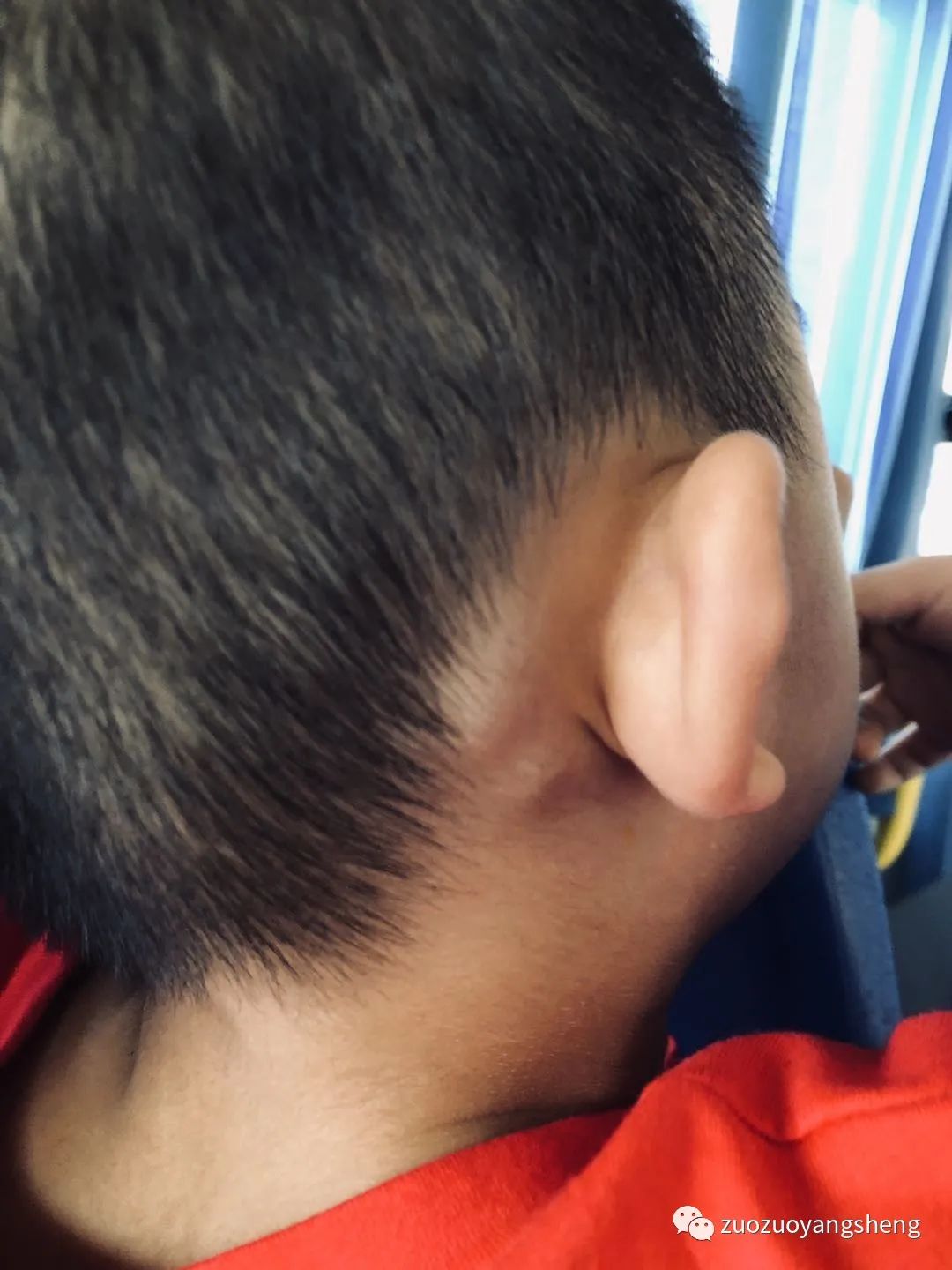 微问答184期：孩子头上肿包溃烂，网上查的资料好令人着急的……