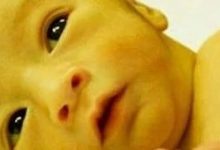 宝宝黄疸怎么办？（附手法视频）-原始点全球同学网