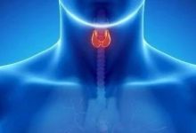 案例分享:甲状腺肿瘤,腹部有硬块皮表呈黑色案例分享-原始点全球同学网