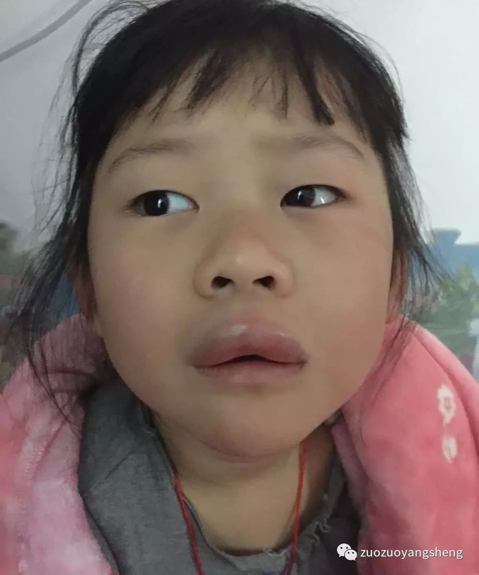案例分享：原始点调理新年“食物中毒”的案例-原始点全球同学网