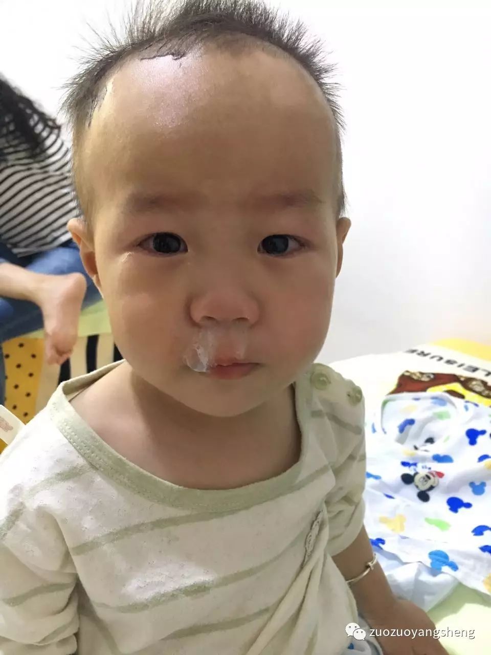 原始点调理幼儿咳嗽后出现严重好转反应