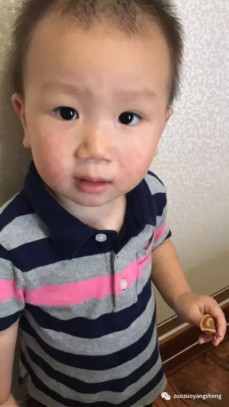 原始点调理小朋友过程中所出现的好转反应大总结 原始点调理小朋友过程中所出现的好转反应大总结