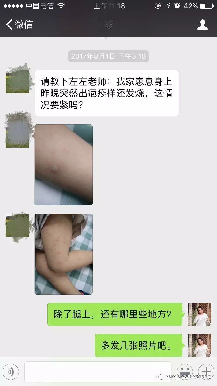 原始点调理幼儿咳嗽后出现严重好转反应