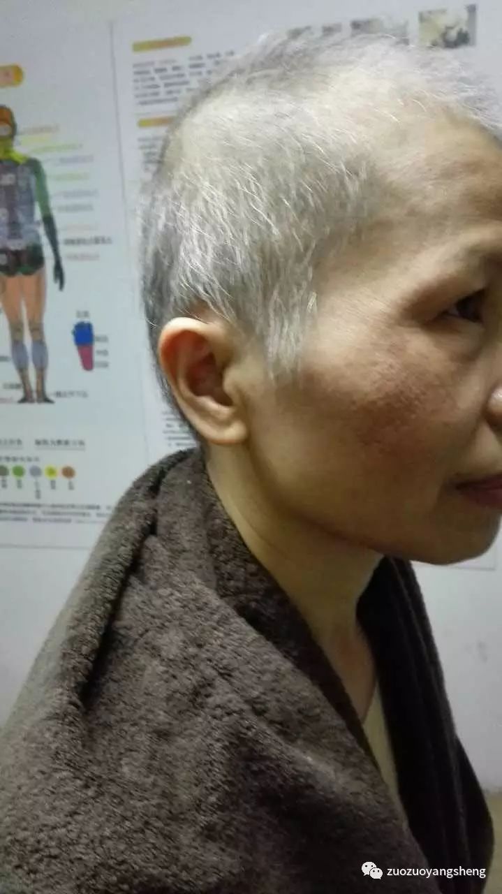 案例分享:原始点调理乳癌的成功案例 案例分享:原始点调理乳癌的成功案例