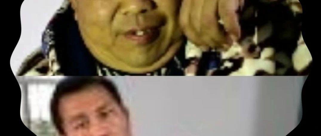 中年男士脑梗后遗症现场调理-原始点全球同学网