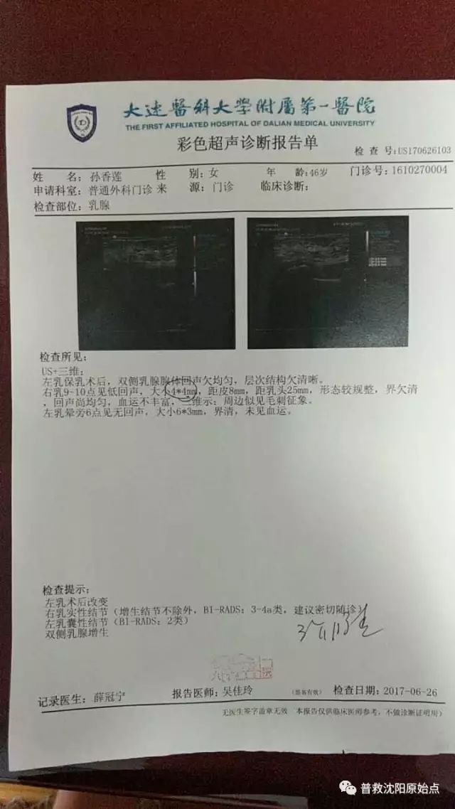 原位乳腺癌保乳再生追踪 原位乳腺癌保乳再生追踪