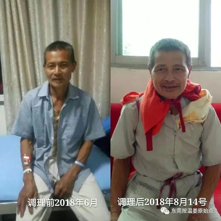 直肠癌没经手术放化疗，肠梗阻，肺结核，肺气肿