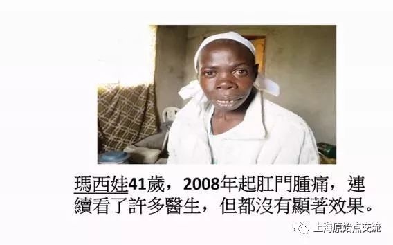 原始点处理痔疮案例合集 原始点处理痔疮案例合集