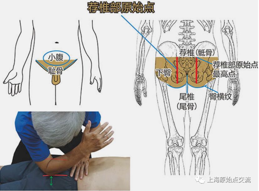 原始点处理痔疮案例合集 原始点处理痔疮案例合集