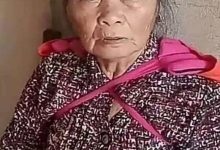 椎体压缩性改变，双膝痛等-原始点全球同学网