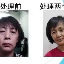 肺炎吐血案例 2017年马来西亚张钊汉原始点推广中心志工-原始点全球同学网
