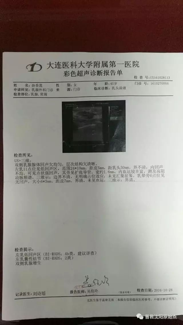 原位乳腺癌保乳再生追踪 原位乳腺癌保乳再生追踪