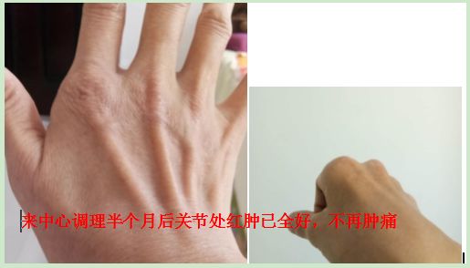 原始点调好多年类风湿