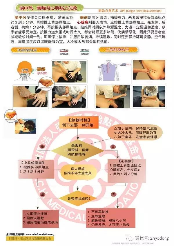脑中风、癫痫、心脏病之院前急救。原始点复苏术 OPR (Origin Point Resuscitation)-原始点全球同学网