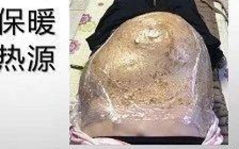 腹水案例-2019年7月12日，腹部变小变软。-原始点全球同学网