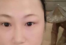 連續咳嗽兩個月運動半小時解癥-原始點全球同學網