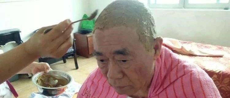 深圳范先生70岁脑瘤手术后遗症-原始点全球同学网