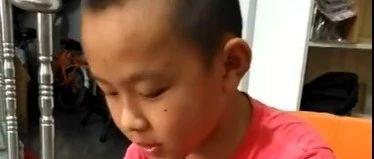厦门同学水痘案例-原始点全球同学网