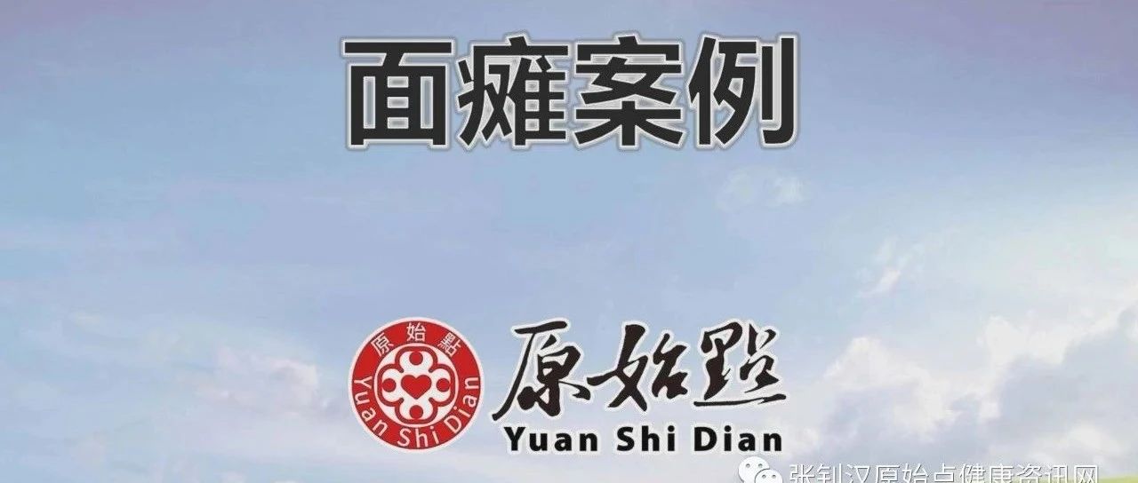 面瘫案例（汶莱） 2020-12-原始点全球同学网
