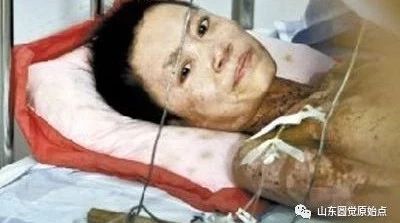 原始点案例：艾滋病-2018苏州案例-原始点全球同学网