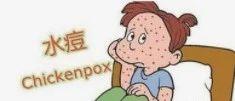 厦门家至善小义工长水痘自我调理康复案例-原始点全球同学网