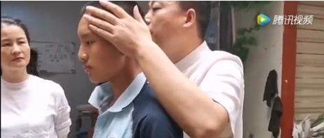 初中生急性荨麻疹两天康复-原始点全球同学网