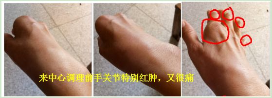 原始点调好多年类风湿