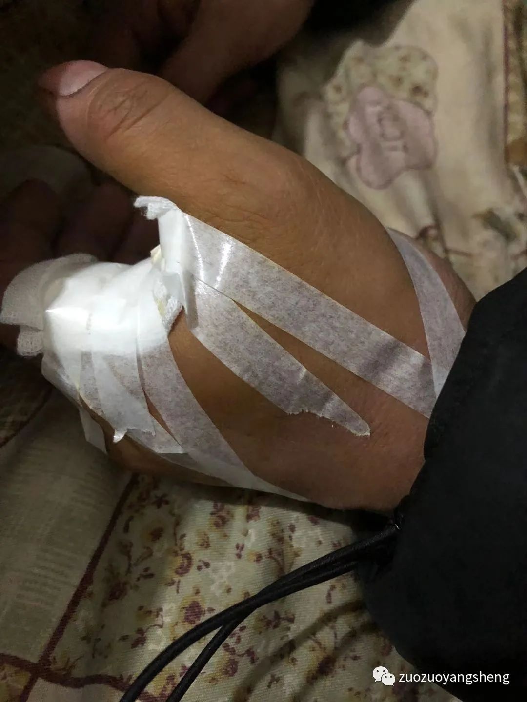 微问答221期：虎口被剪刀刺伤，去医院打了破伤风后能不能用原始点调理？