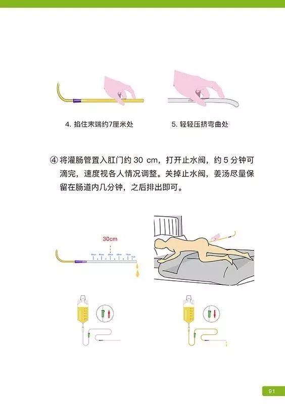 原始点姜汤灌肠步骤-更新版（2020年1月）