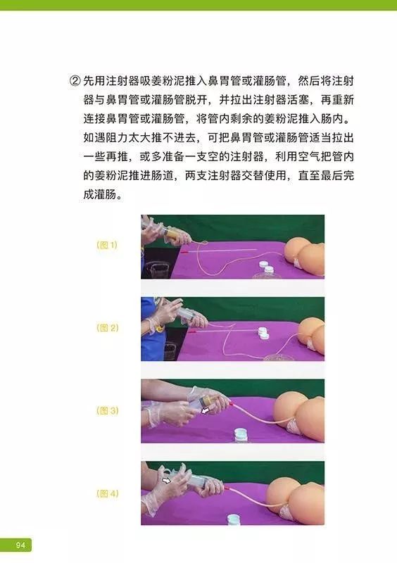 原始点姜粉泥灌肠步骤-更新版(2020年1月) 原始点姜粉泥灌肠步骤-更新版(2020年1月)