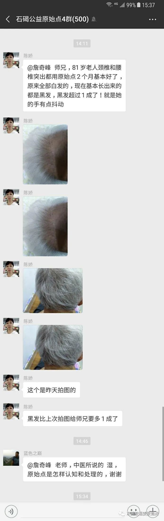 81岁老太太白发变黑 81岁老太太白发变黑
