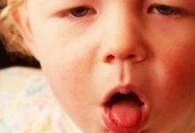 案例分享:原始点调理小孩咳血两次见效的案例。-原始点全球同学网