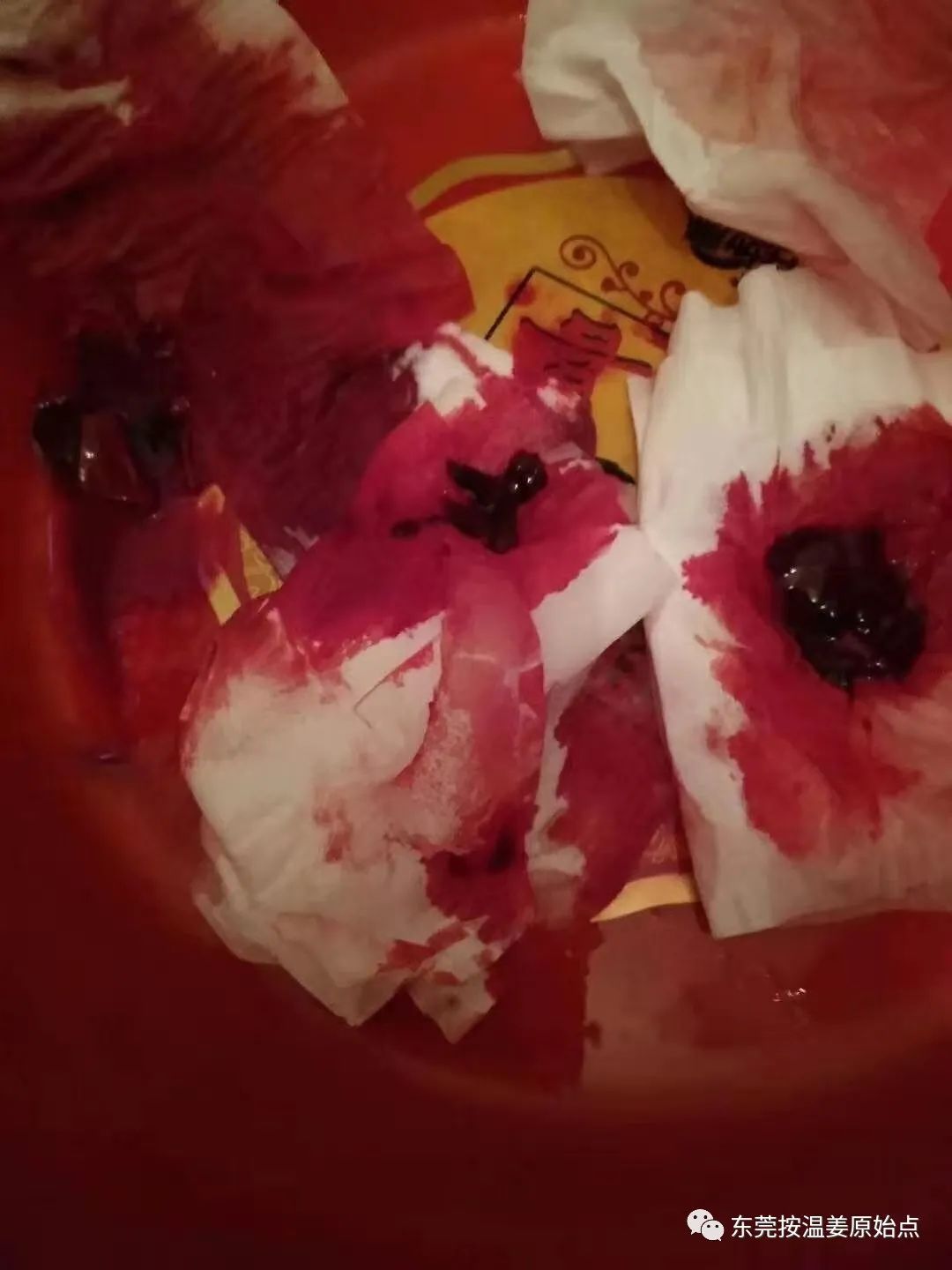 用原始点排出死胎,免除刮宫手术 用原始点排出死胎,免除刮宫手术