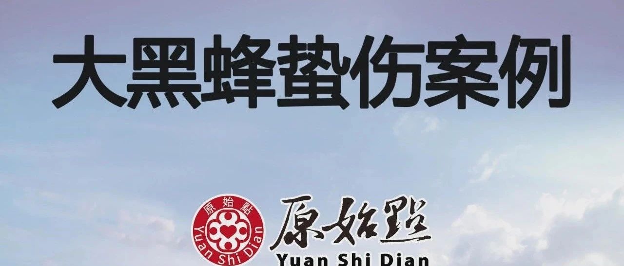 大黑蜂螫傷案例-原始点全球同学网
