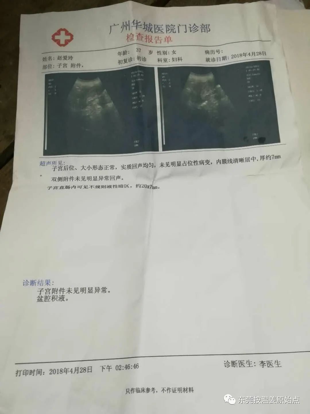 严重妇科病:阴道炎,宫颈炎,盘腔积液 严重妇科病:阴道炎,宫颈炎,盘腔积液