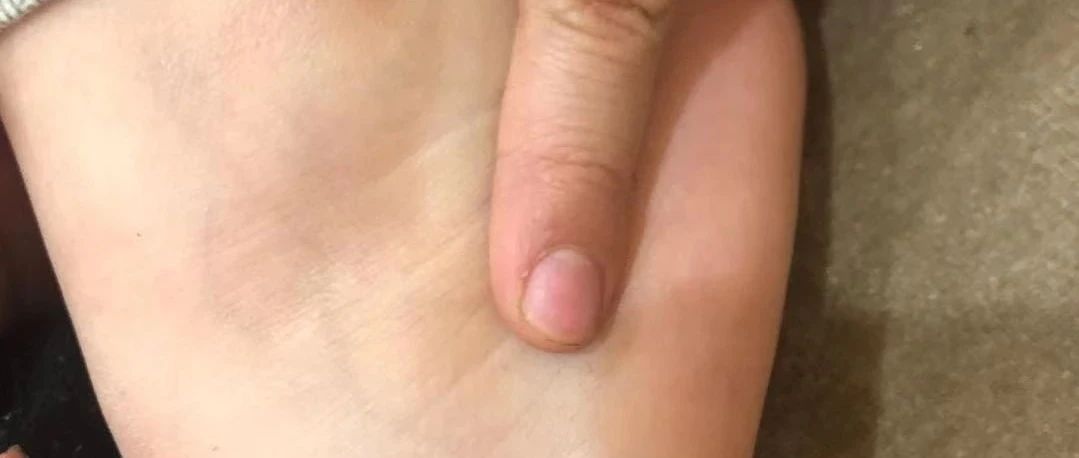 微问答219期：孩子摔跤后痛的走不了路了，调理五天一直没好彻底怎么办？-原始点全球同学网