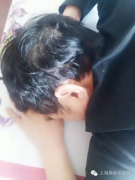 原始点案例：耳鸣脑鸣耳聋（24）小时案例