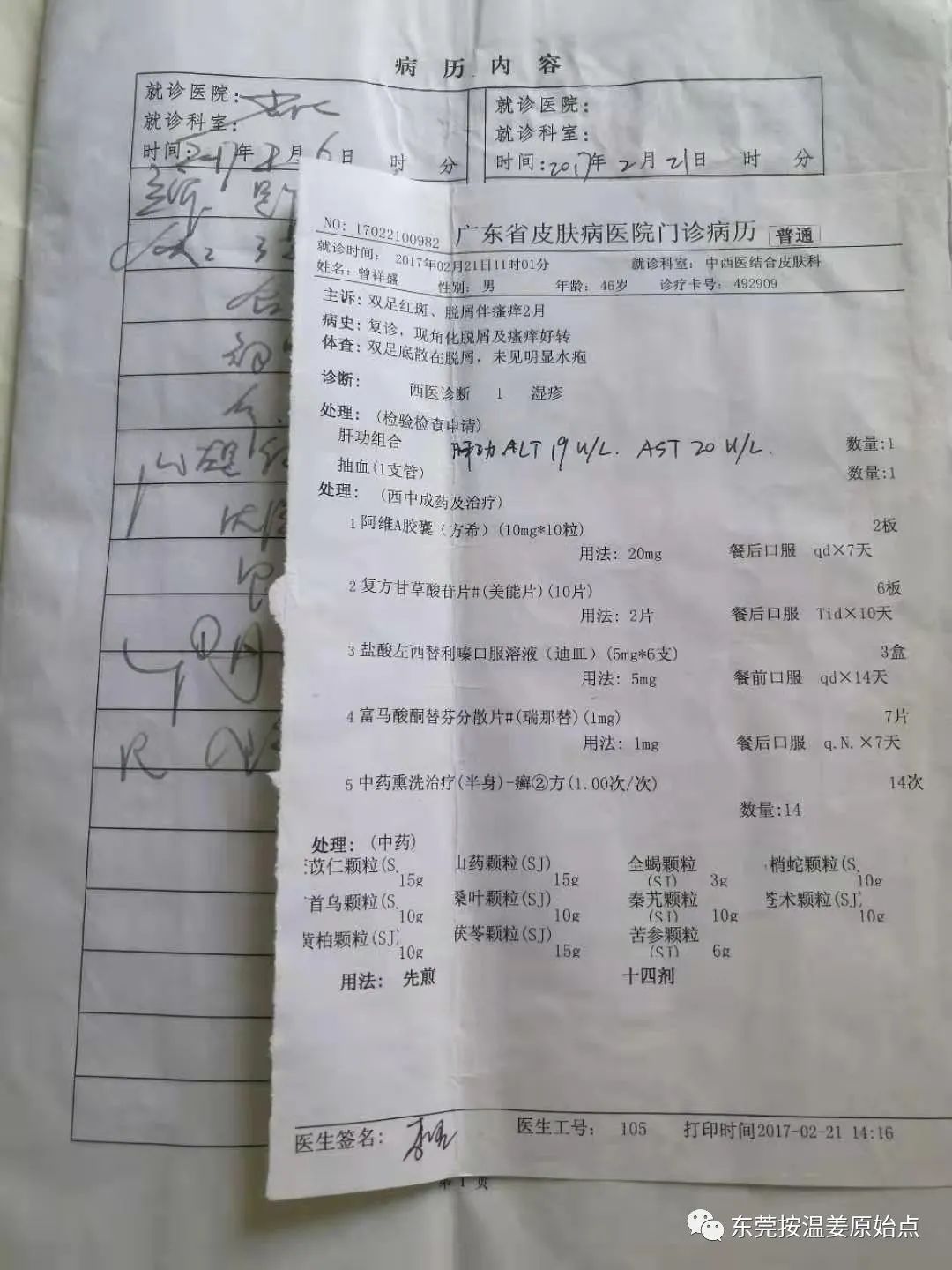 严重湿疹,真菌感染 严重湿疹,真菌感染