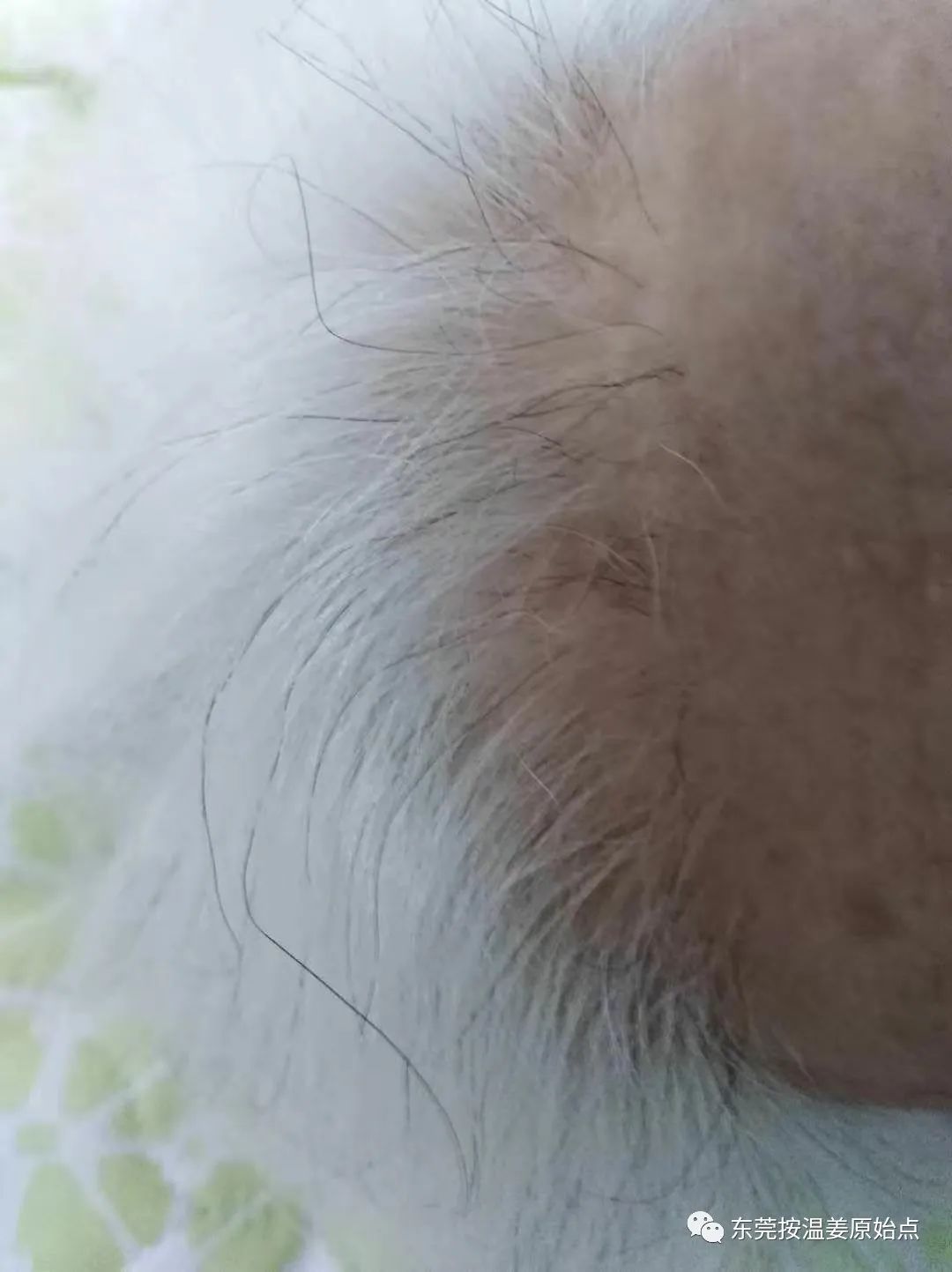 81岁老太太白发变黑 81岁老太太白发变黑