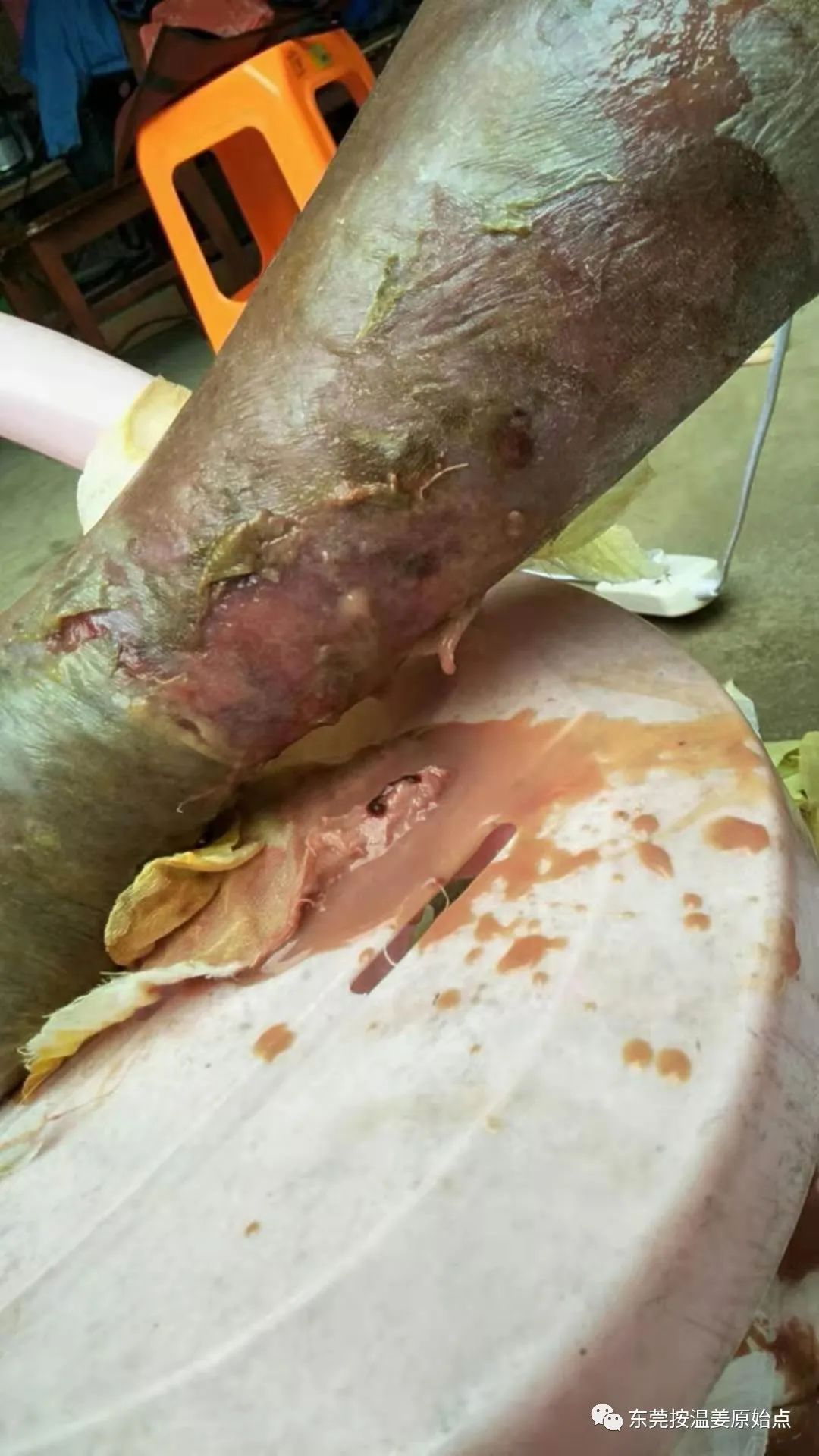 原始点让87岁中风的老爷爷免除截肢,重新行走 原始点让87岁中风的老爷爷免除截肢,重新行走