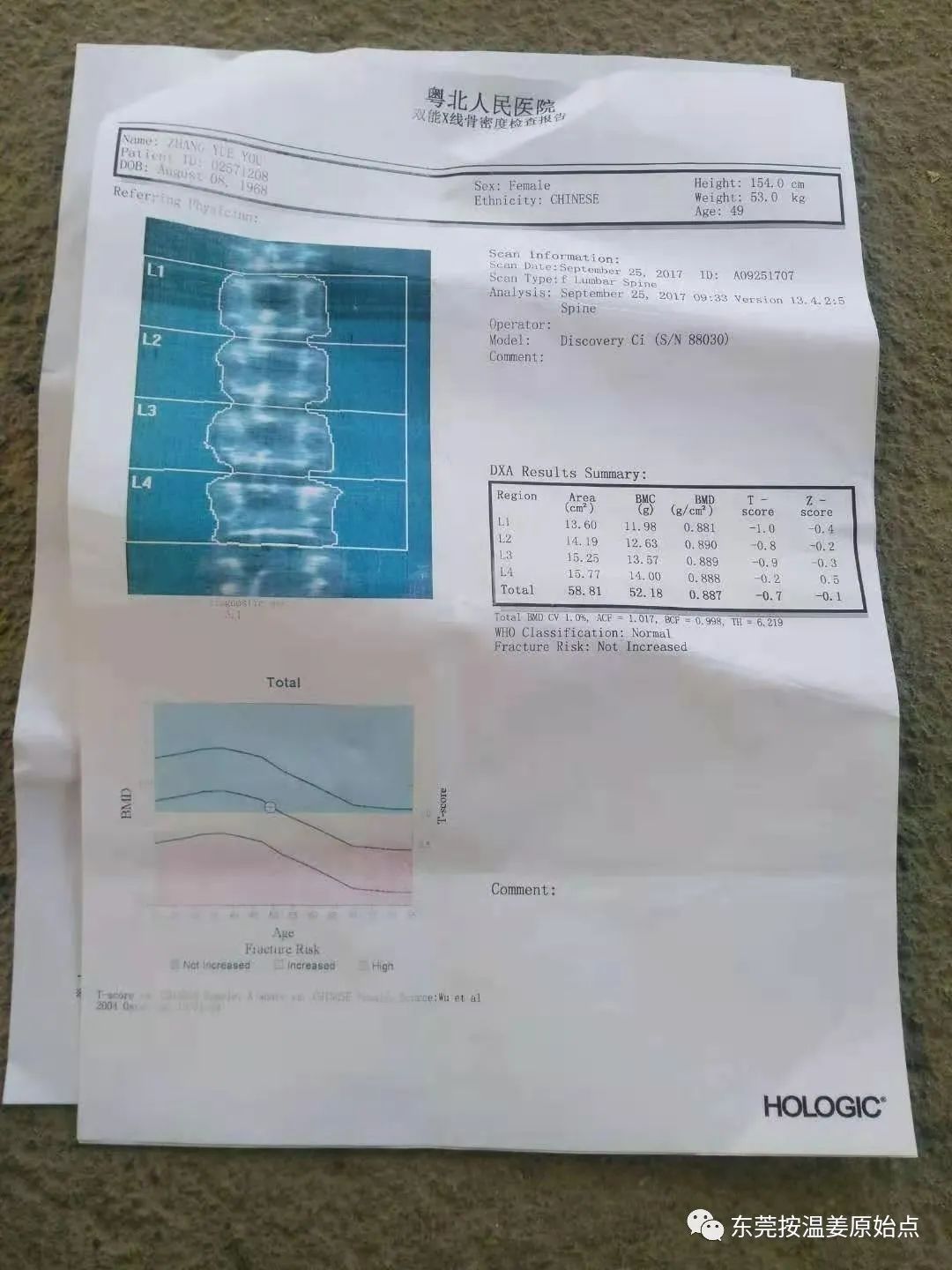 乳腺增生,腰椎间盘突出,骨质增生 乳腺增生,腰椎间盘突出,骨质增生