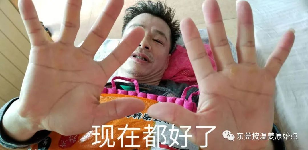 严重湿疹,真菌感染 严重湿疹,真菌感染