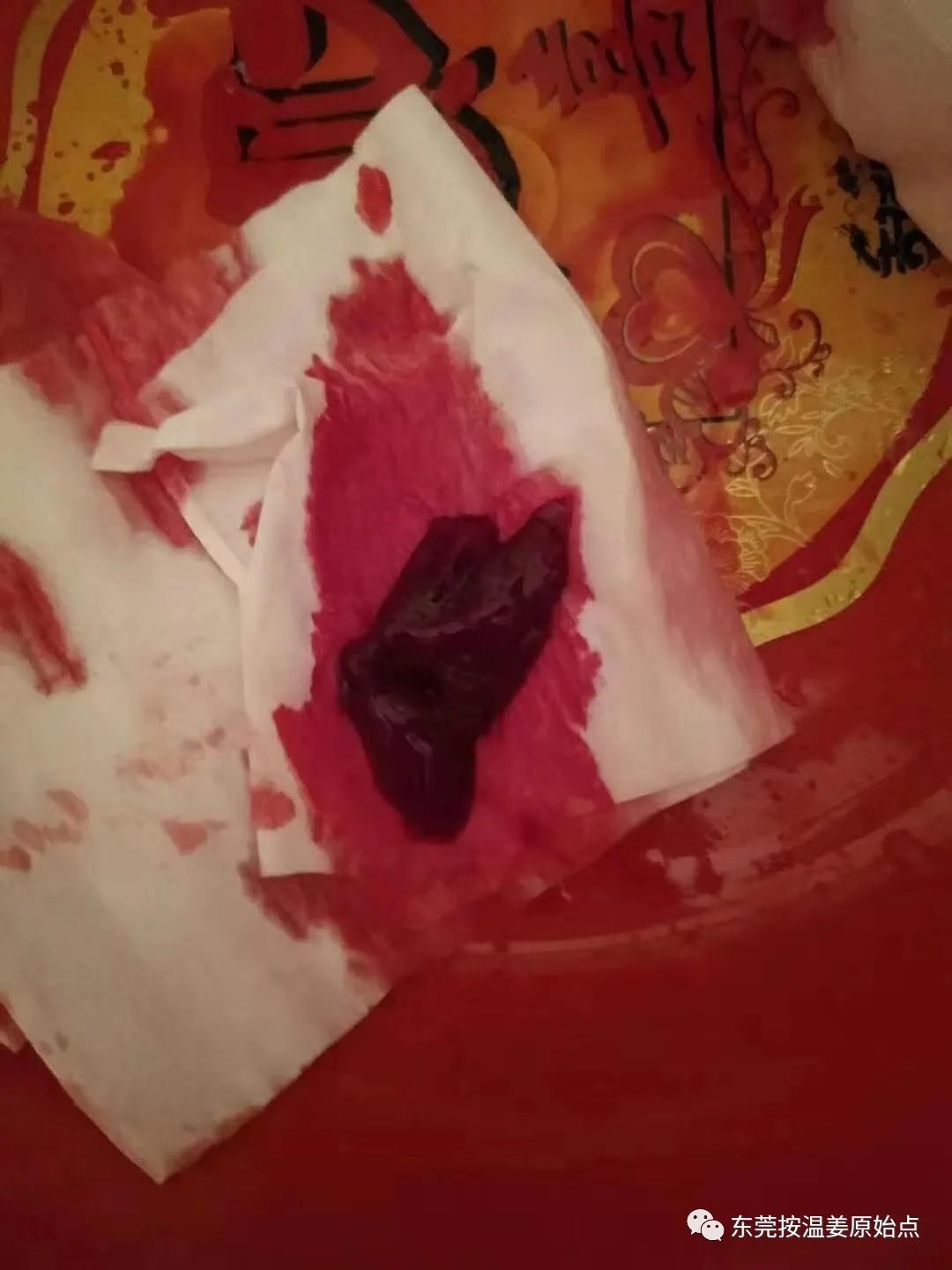 用原始点排出死胎,免除刮宫手术 用原始点排出死胎,免除刮宫手术