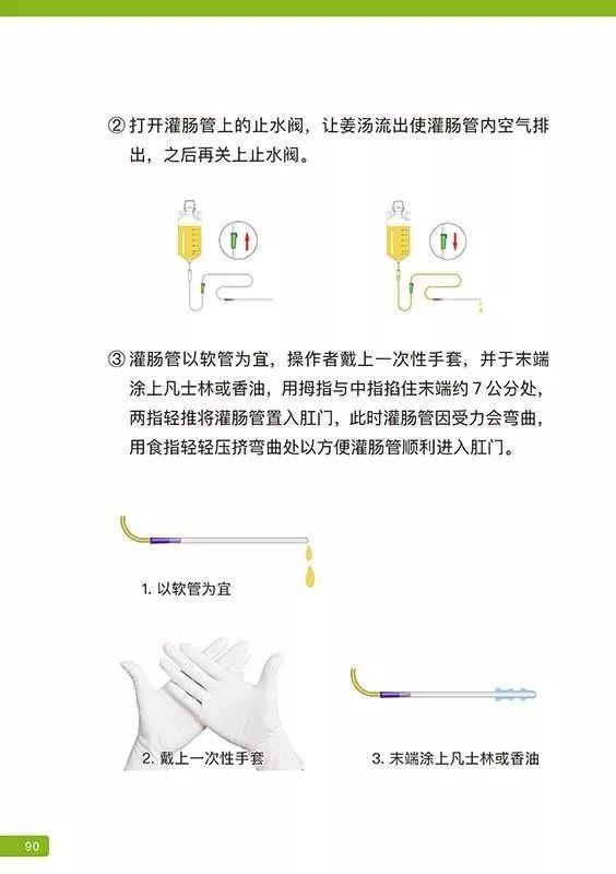 原始点姜汤灌肠步骤-更新版（2020年1月）