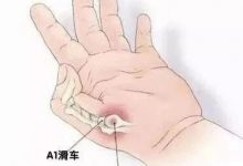 案例分享:原始点调理2岁宝宝腱鞘炎的案例-原始点全球同学网