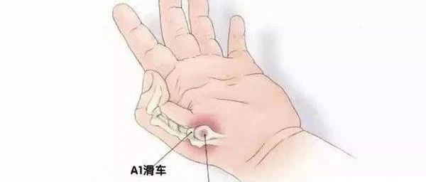 案例分享：原始点调理2岁宝宝腱鞘炎的案例-原始点全球同学网