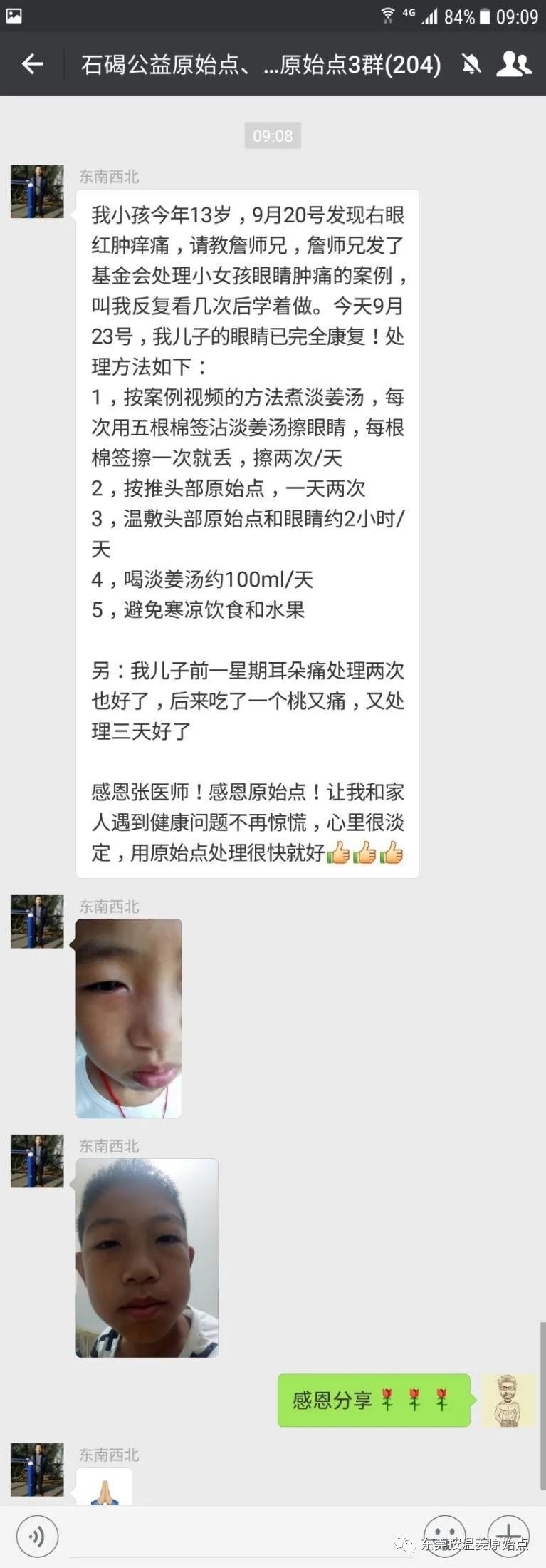 小孩眼睛红肿,耳朵痛,用原始点自己处理 小孩眼睛红肿,耳朵痛,用原始点自己处理