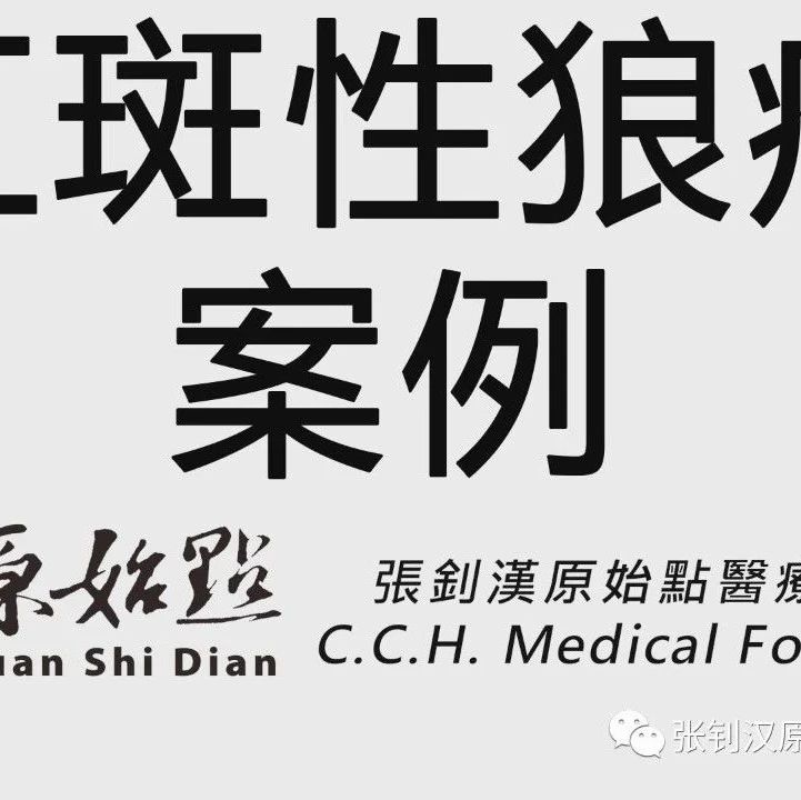 台湾学员 红斑性狼疮案例 视频 参加学习营 停掉二十几年药。-原始点全球同学网