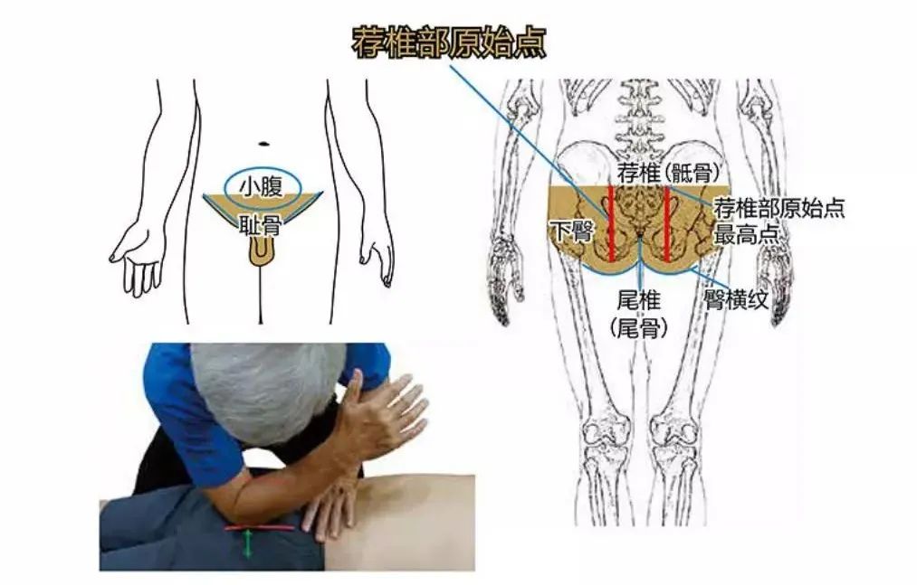把原始点带回家 孝敬爸妈——腿部案例