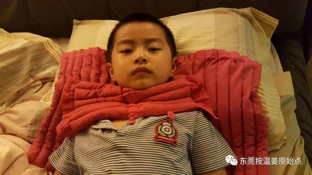 小孩严重咳嗽，发烧